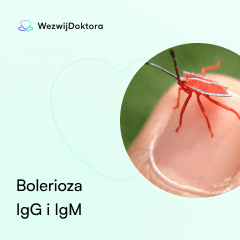 Bolerioza  IgG i IgM
